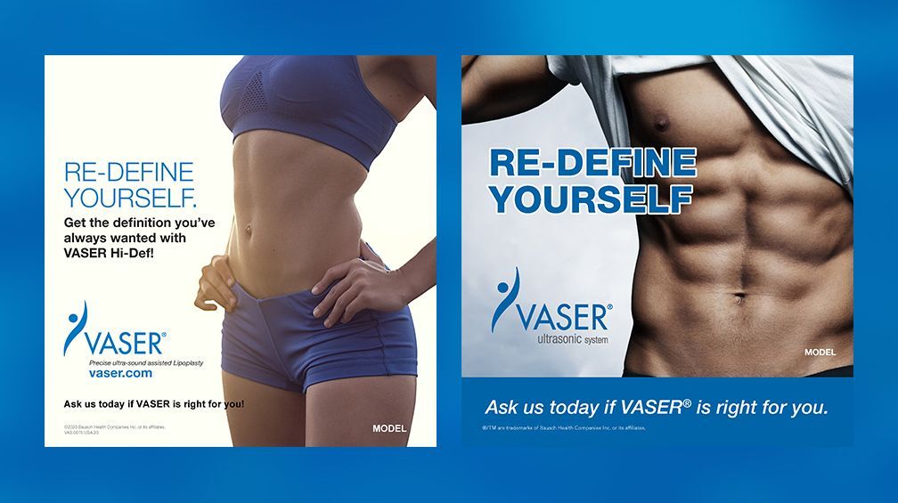 VASER Liposuction Scottsdale, Az
